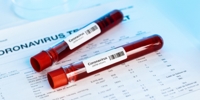 120926755_3537235536297517_240552913603379539_n